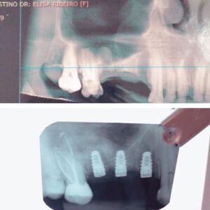 Dra Elisa Mourao Implantodontia e Periodontia 8
