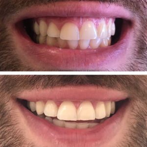 Dra Elisa Mourao Implantodontia e Periodontia 9