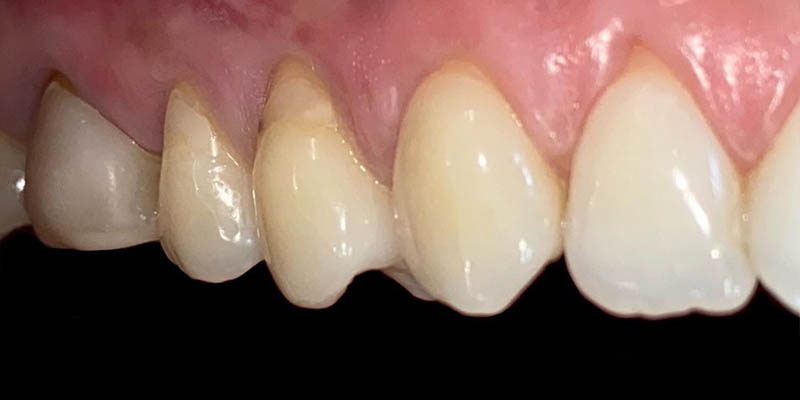 dra elisa mourao periodontia 1 dra elisa mourao periodontia 1