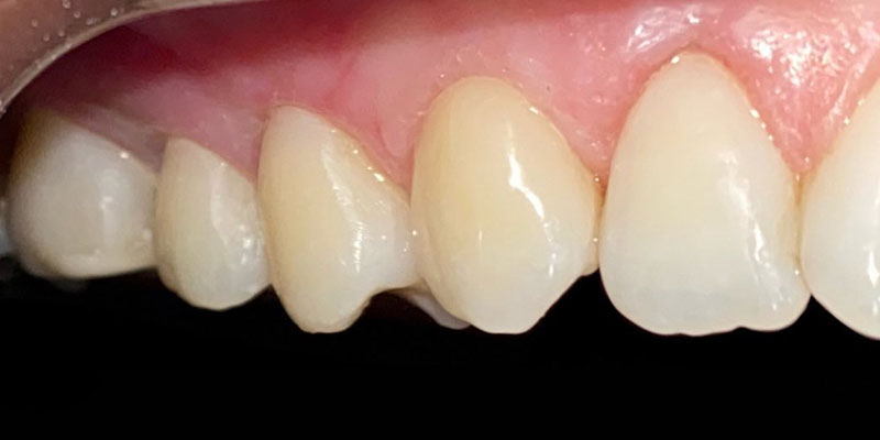 dra elisa mourao periodontia 2