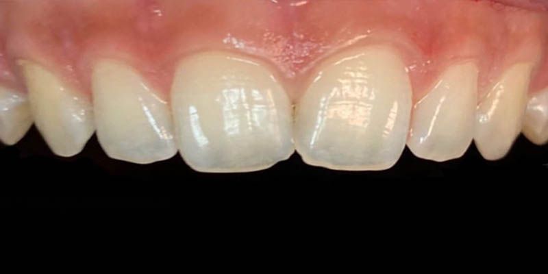 dra elisa mourao periodontia 3 dra elisa mourao periodontia 3