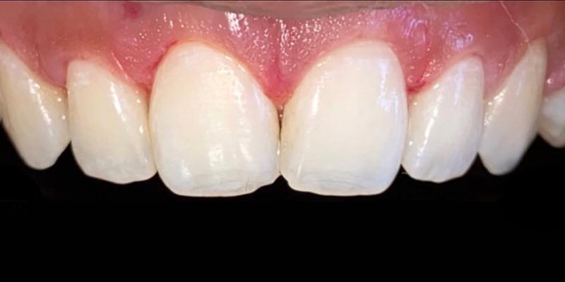 dra elisa mourao periodontia 4