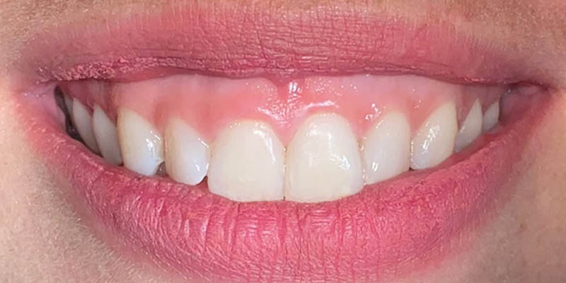 dra elisa mourao periodontia 5 dra elisa mourao periodontia 5